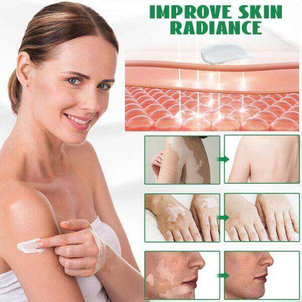 Creme para Manchas Brancas Biancat™