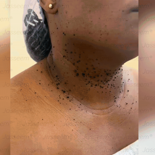 𝐉𝐚𝐬𝐬𝐞𝐞𝐦® Усъвършенстван неинвазивен CO₂ лазер за възстановяване на кожата 🎉 (Нежно премахва брадавици, бенки, старчески петна и кожни образувания – без болка, без суетене!)