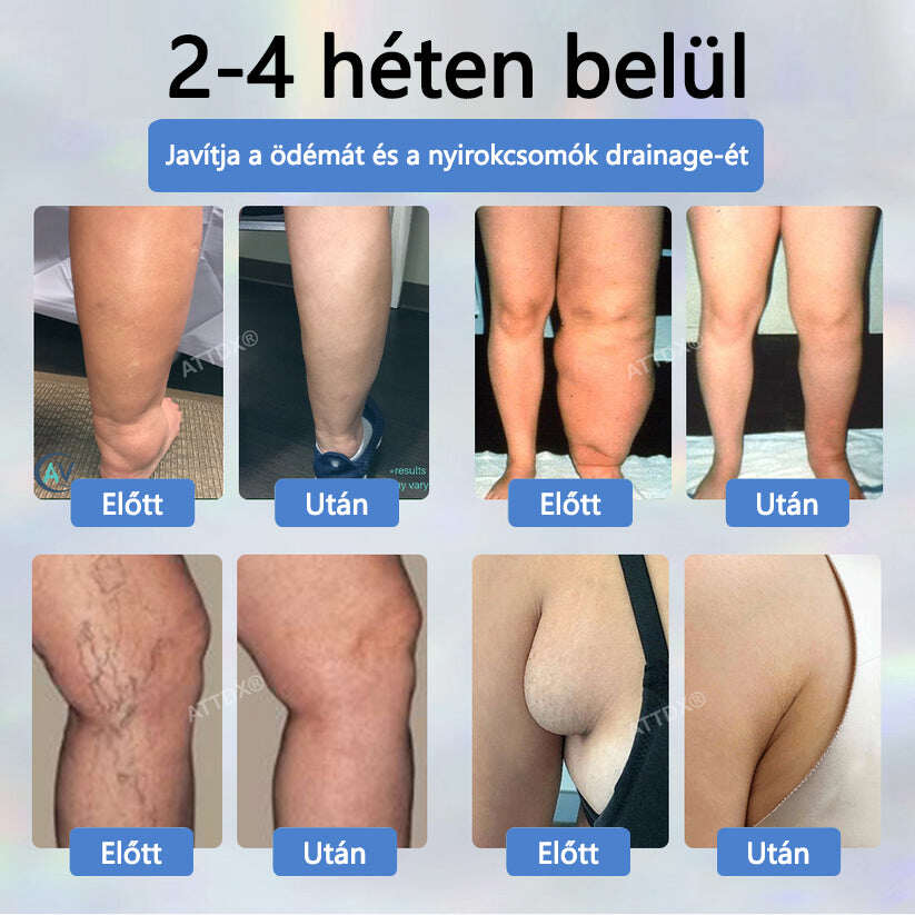 Cvreoz® Fekete kömény Ödéma méregtelenítő gyógynövénykrém💙
