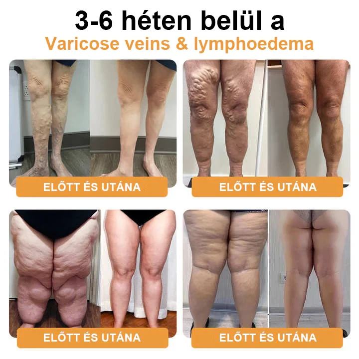 JOSFIT Ultradźwiękowa Liposukcja i Daleka Podczerwień Opaska Detox do Wyrównywania Poziomu Cukru We Krwi - Energy Balance Wyprzedaż Ograniczona Czasowo