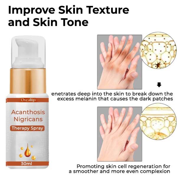 Spray de terapia Oveallgo™ Acantose Nigricans