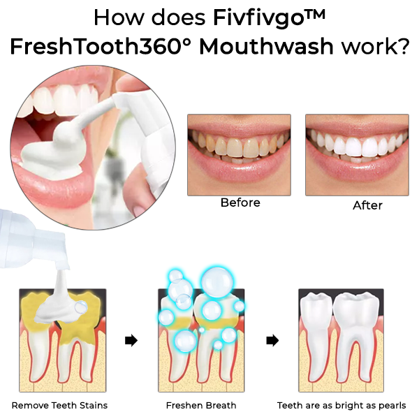 Fivfivgo™ FreshTooth360° szájvíz - Mélytisztító szájvíz