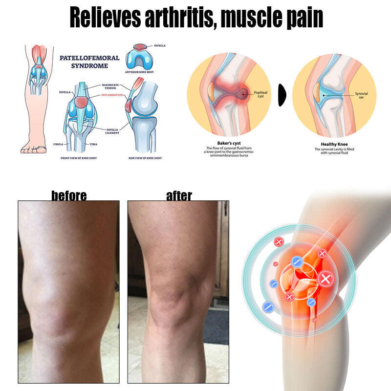 Routlets™🔥Pulseira de terapia magnética linfática💎