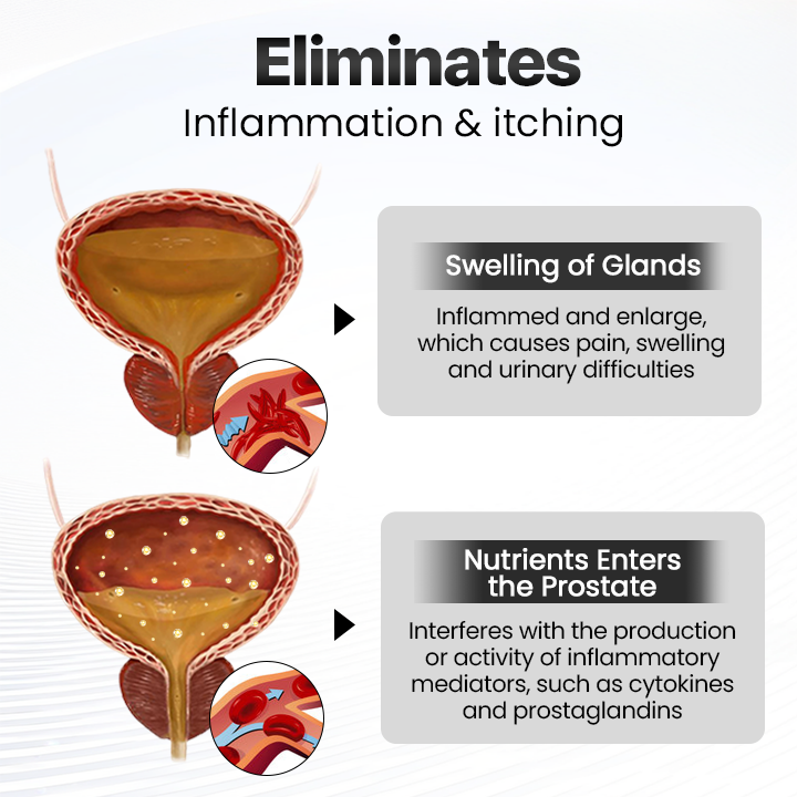 Инхалатор за назална терапия Biancat™ BeeBreathe Prostate Care