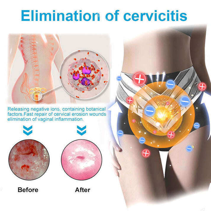 🎉 Предложение за ограничено време - Голяма отстъпка! 🔥 До 90% ОТСТЪПКА! 💰 Къси панталони с турмалиново оформящо облекло Sfrcord™ от титанови влакна✅✅