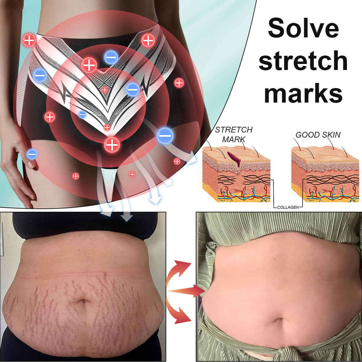 Últimas 3 horas: 80% DE DESCONTO 🔥 Shorts modeladores de turmalina autoaquecidos em fibra de titânio Neslemy™