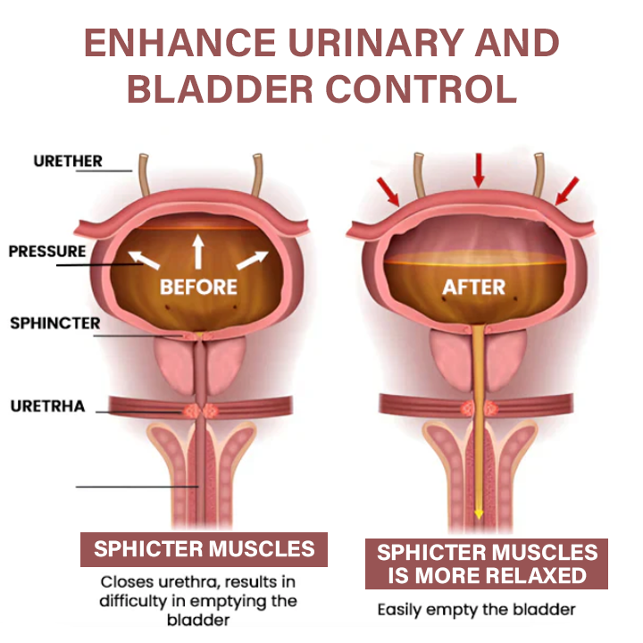 Пръстен за облекчаване на простатата Oveallgo™ MagnaCopper