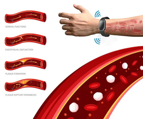 Ultrazvukový náramek pro tvarování těla SEAGRI Ultra-Tech