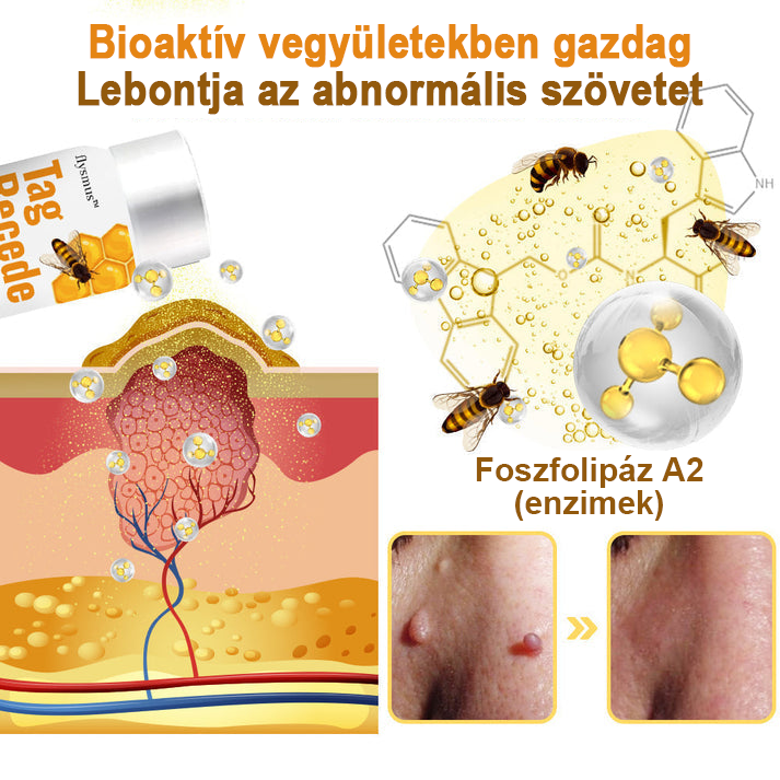 【💗utánvétel (COD)💗】Méhméreg szemölcs és övsömör eltávolító spray (👨‍⚕AAD Ajánlott) 🐝🐝🔥(🔥Last Day 80% Off)