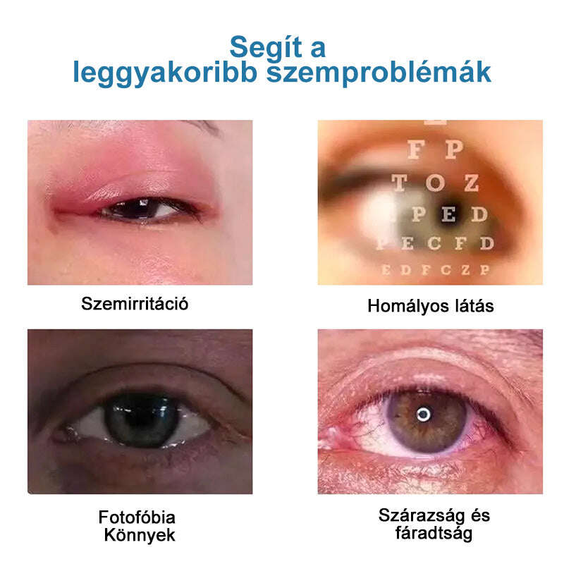 👁️Ouryard™ colírio para tratar problemas de visão