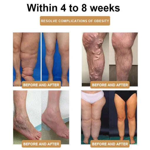 Fivfivgo™ Ултразвукова гривна за премахване на мазнините и детоксикация - енергиен баланс