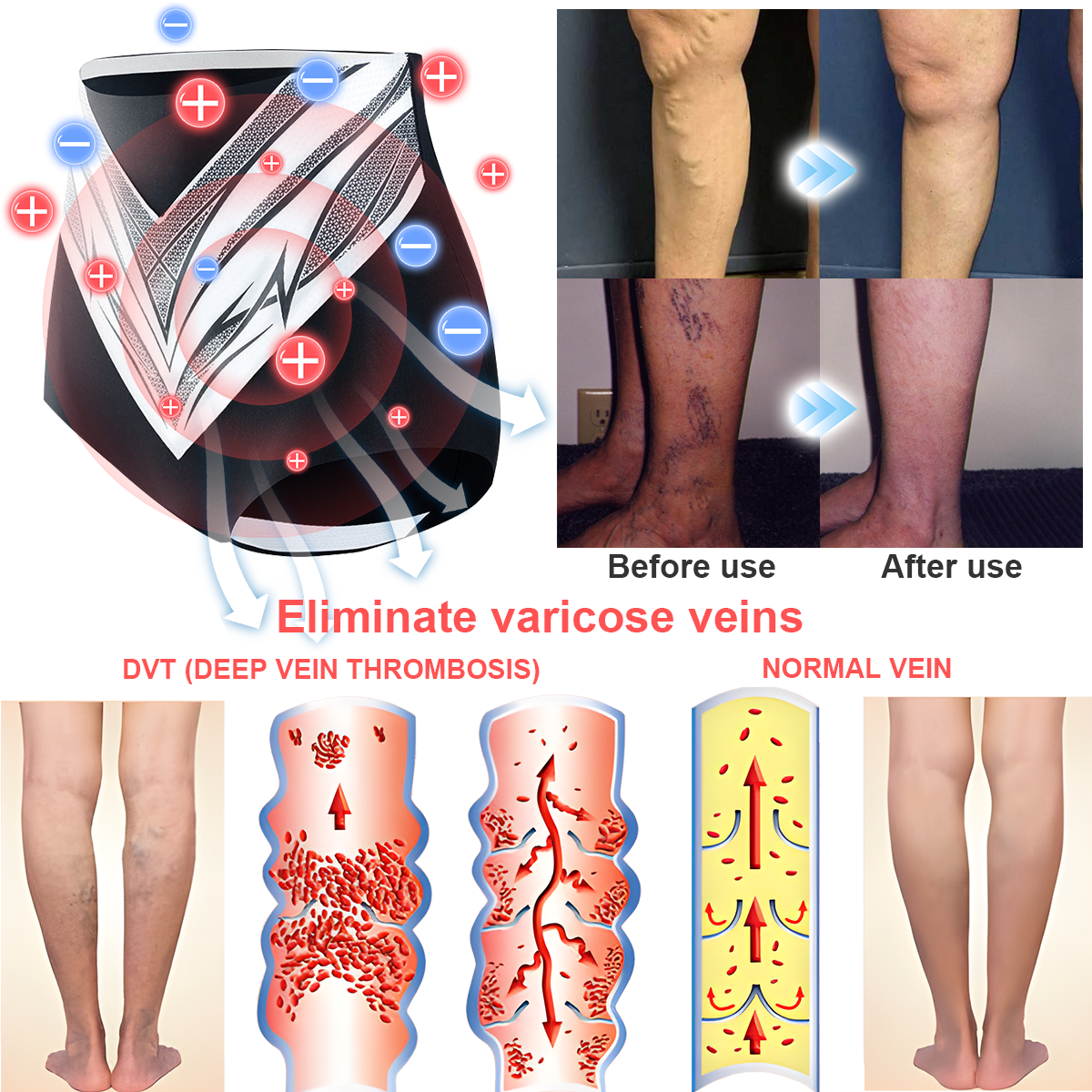 🎉 Предложение за ограничено време - Голяма отстъпка! 🔥 До 90% ОТСТЪПКА! 💰 Къси панталони с турмалиново оформящо облекло Sfrcord™ от титанови влакна✅✅