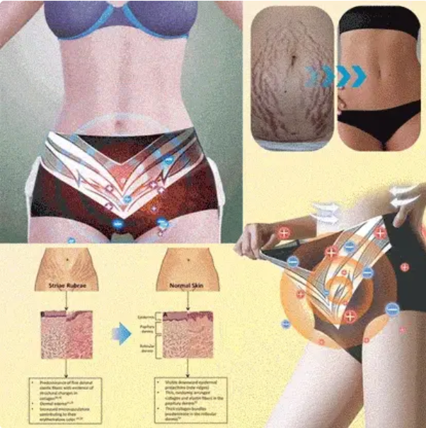 Calções modeladores de turmalina com autoaquecimento de fibra de titânio de grau médico