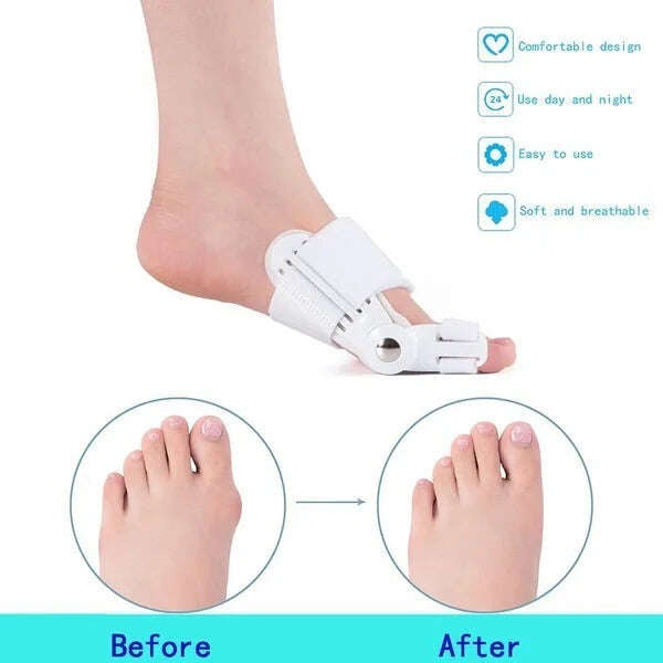 【Doctor recommended】Bunion Corrector para homens e mulheres