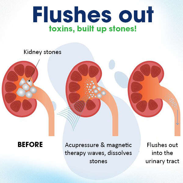 MEDPLUS™ АКУПРЕСУРЕН КОЛАН ЗА ГРИЖА ЗА БЪБРЕЦИТЕ