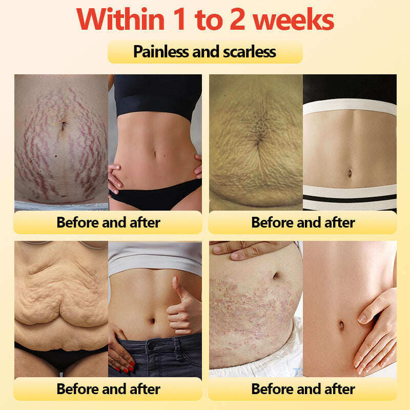 【ILF R&D】PaURAJU™ Магнитни турмалинови оформящи шорти ❤️ Голяма новогодишна разпродажба 40%