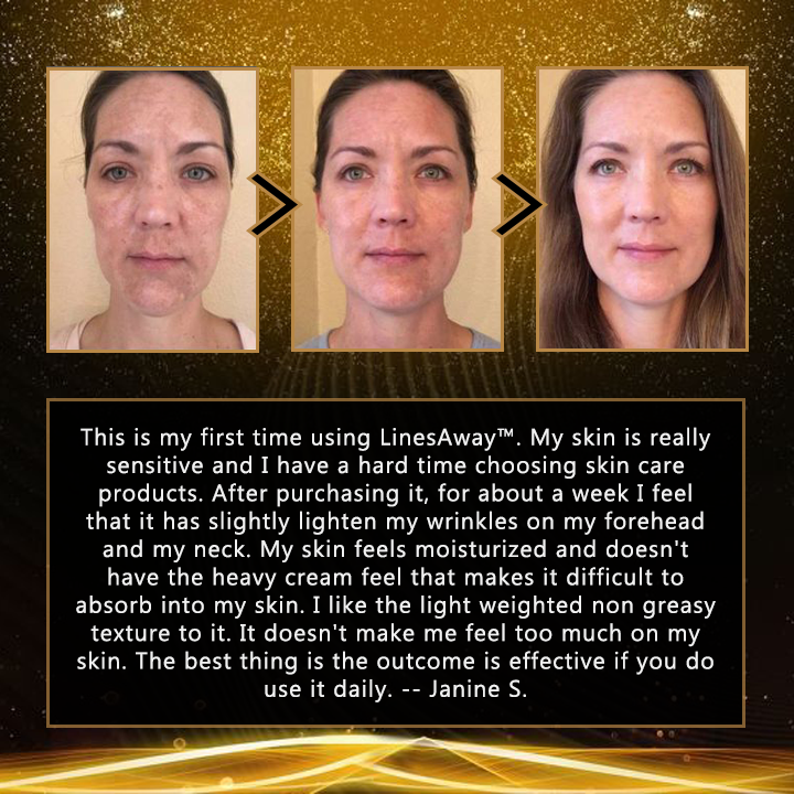 LinesAway™ Fullerene Placenta Essence