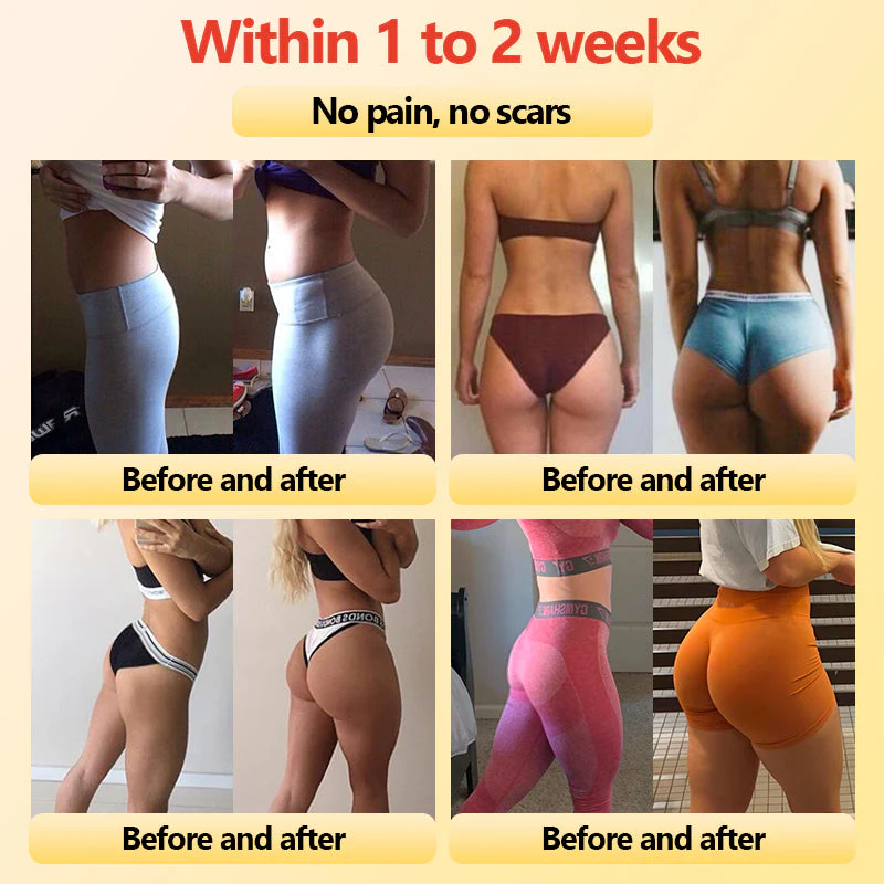 Shorts modeladores de turmalina autoaquecidos de fibra de titânio de grau médico 🔥