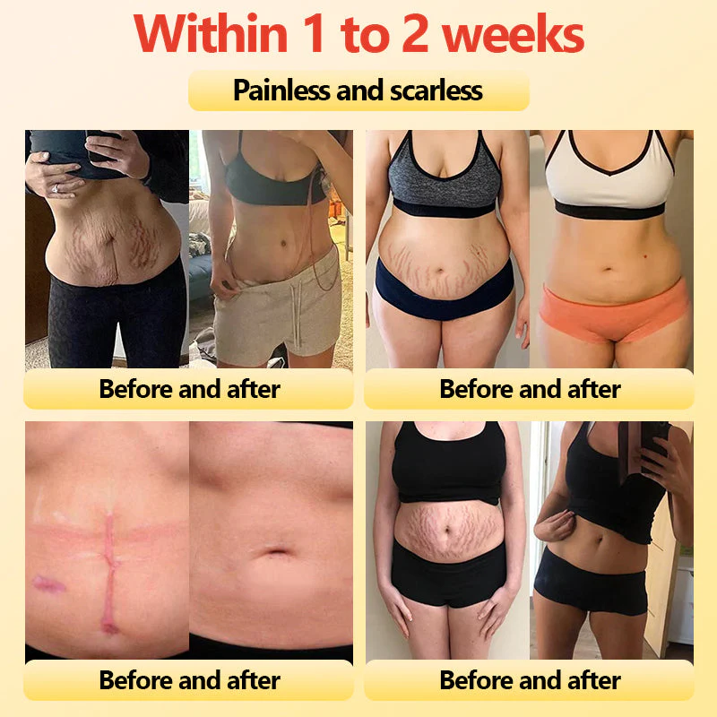 Shorts modeladores de turmalina autoaquecidos de fibra de titânio de grau médico 🔥