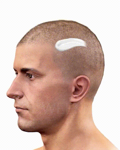 Шампоан против косопад