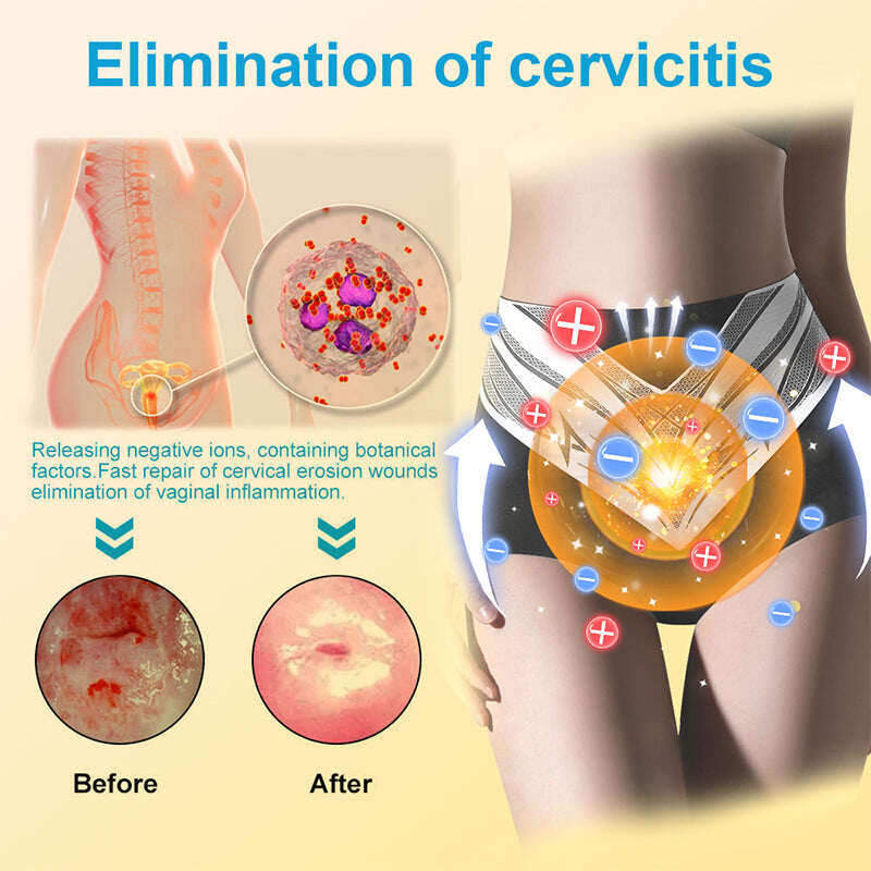 【ILF R&D】PaURAJU™ Магнитни турмалинови оформящи шорти ❤️ Голяма новогодишна разпродажба 40%