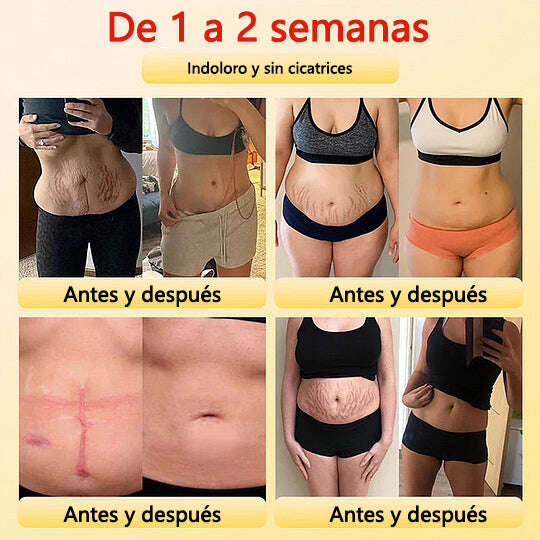 🎉 Oferta por tempo limitado – Grande desconto! 💰 Calções modeladores Anyidea™ de turmalina autorregulada com fibra de titânio