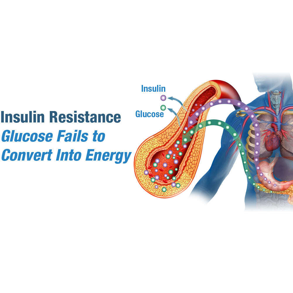 GFOUK™ GlycoNwave elektromos impulzuskészülék