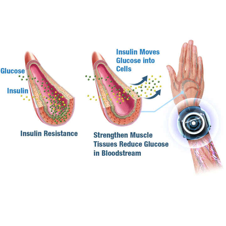GFOUK™ GlycoWave elektromos impulzusgép