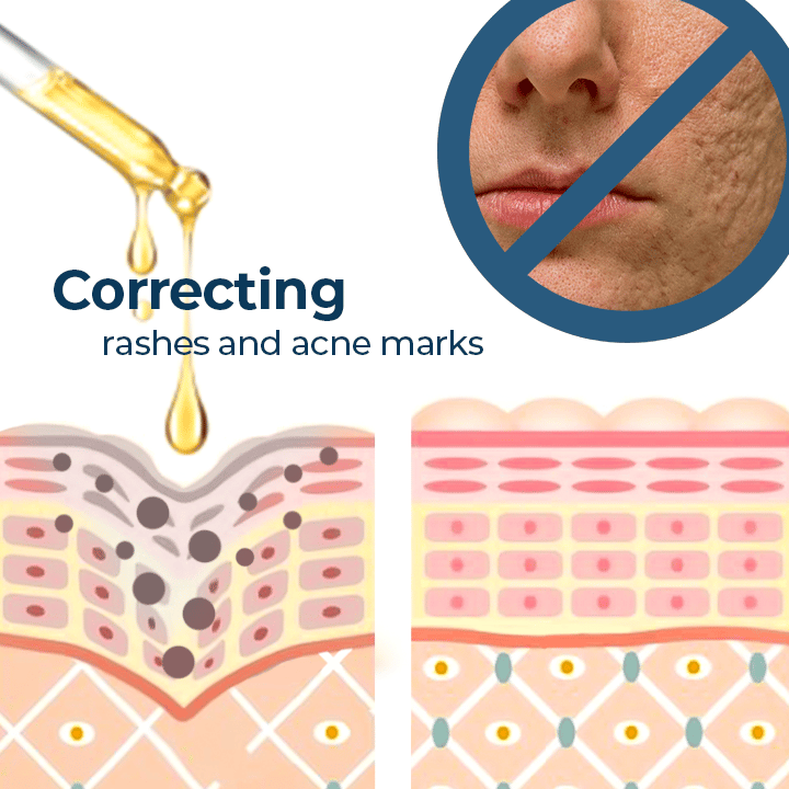 Sérum Antioxidação de Cúrcuma