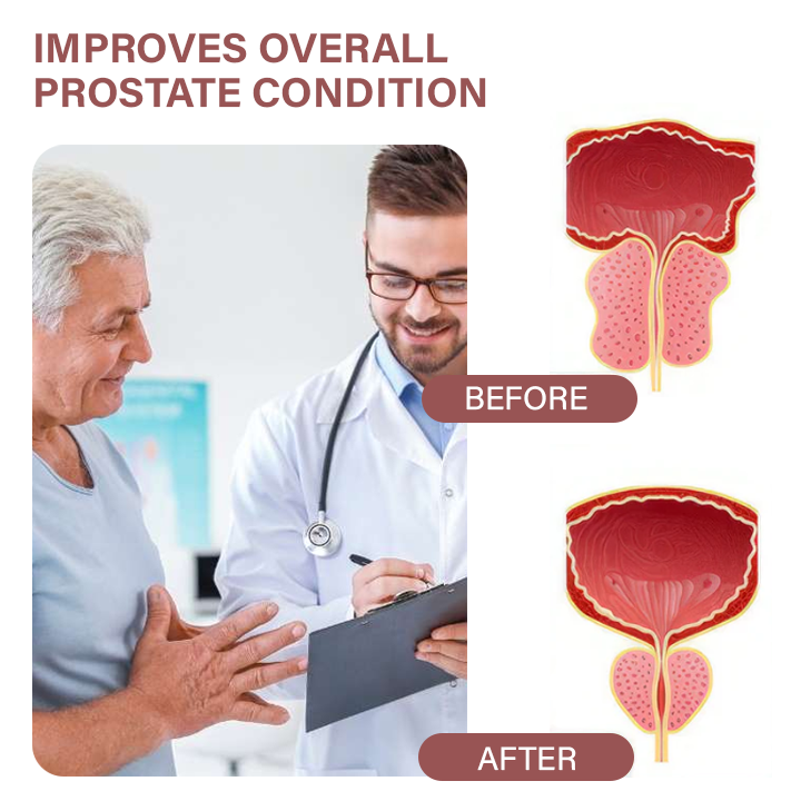 Пръстен за облекчаване на простатата Oveallgo™ MagnaCopper