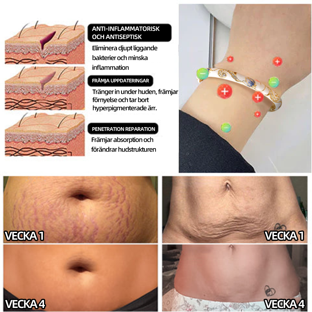 𝐂𝐙𝐓𝐈𝐂𝐋𝐄™ 𝐂𝐥𝐨𝐢𝐬𝐨𝐧𝐧é 𝐞𝐦𝐚𝐥𝐣👩‍⚕️ 𝐥𝐲𝐦𝐟𝐦𝐚𝐠𝐧𝐞𝐭𝐞𝐫 𝐭𝐞𝐫𝐚𝐩𝐞𝐮𝐭𝐢𝐬𝐤𝐭 𝐠𝐮𝐥𝐝𝐚𝐫𝐦𝐛𝐚𝐧𝐝🔥🔥🔥