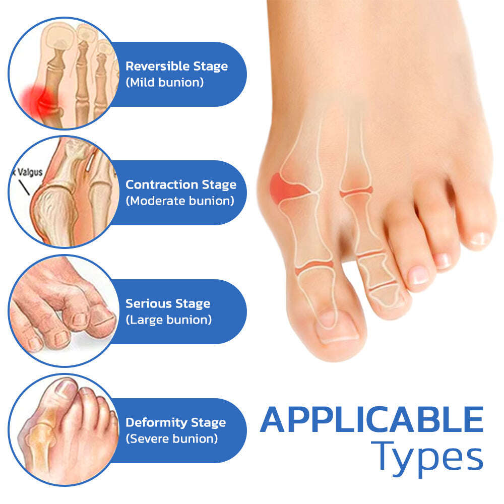 ЧОРАПИ ЗА ЗДРАВЕ GFOUK™ ANTIBUNION И VEINHEAL