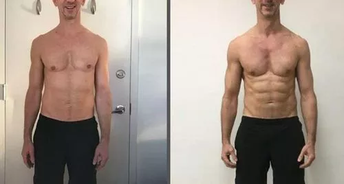 Meias medicinais AFIZ para emagrecimento dos gânglios linfáticos da turmalina