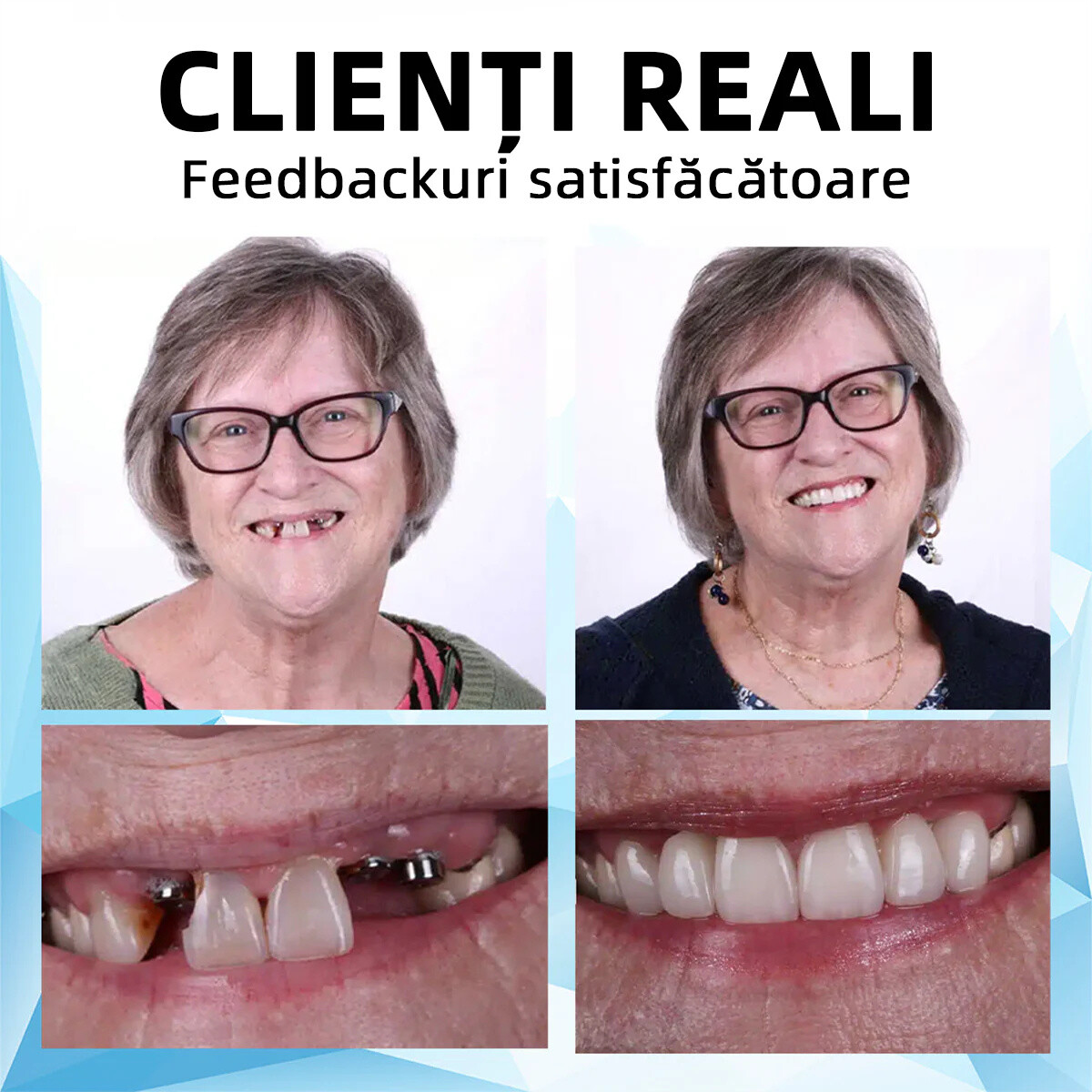 Fogorvosok által ajánlott Bikenda