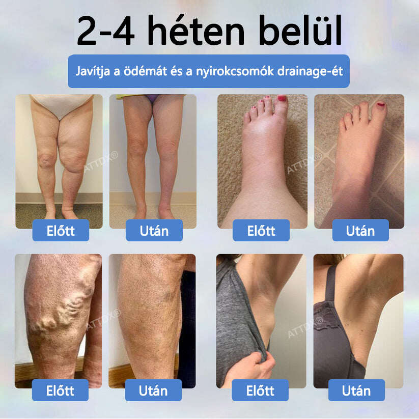 Cvreoz® Fekete kömény Ödéma méregtelenítő gyógynövénykrém💙