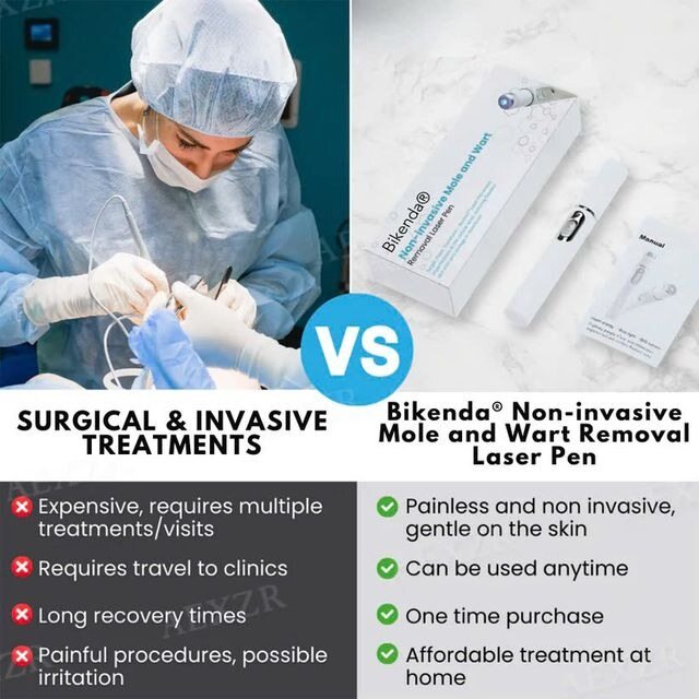 [⚡️NAJLEPSZA OFERTA DZIŚ]🔥Nieinwazyjny laser do usuwania znamion i brodawek