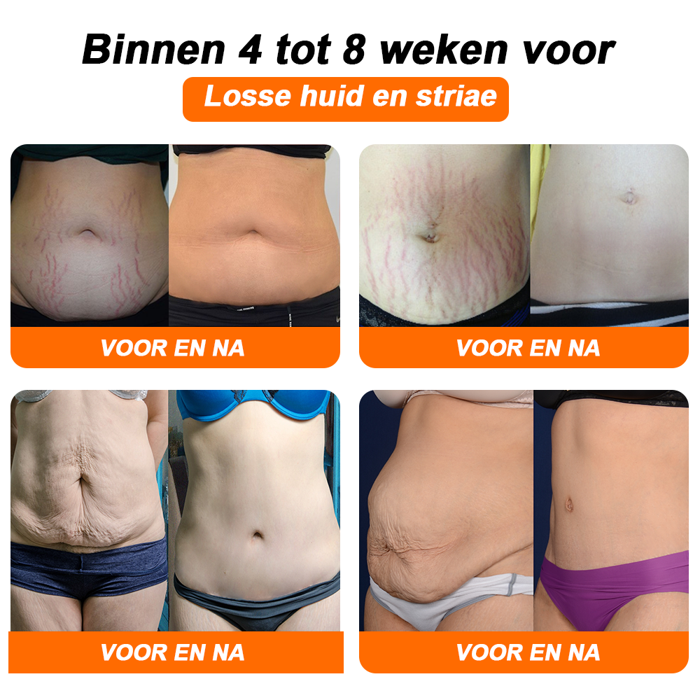 💃💃 Queimador de gordura de íons negativos Kkio™, reafirmante abdominal, 👑Detox Shaper Pants