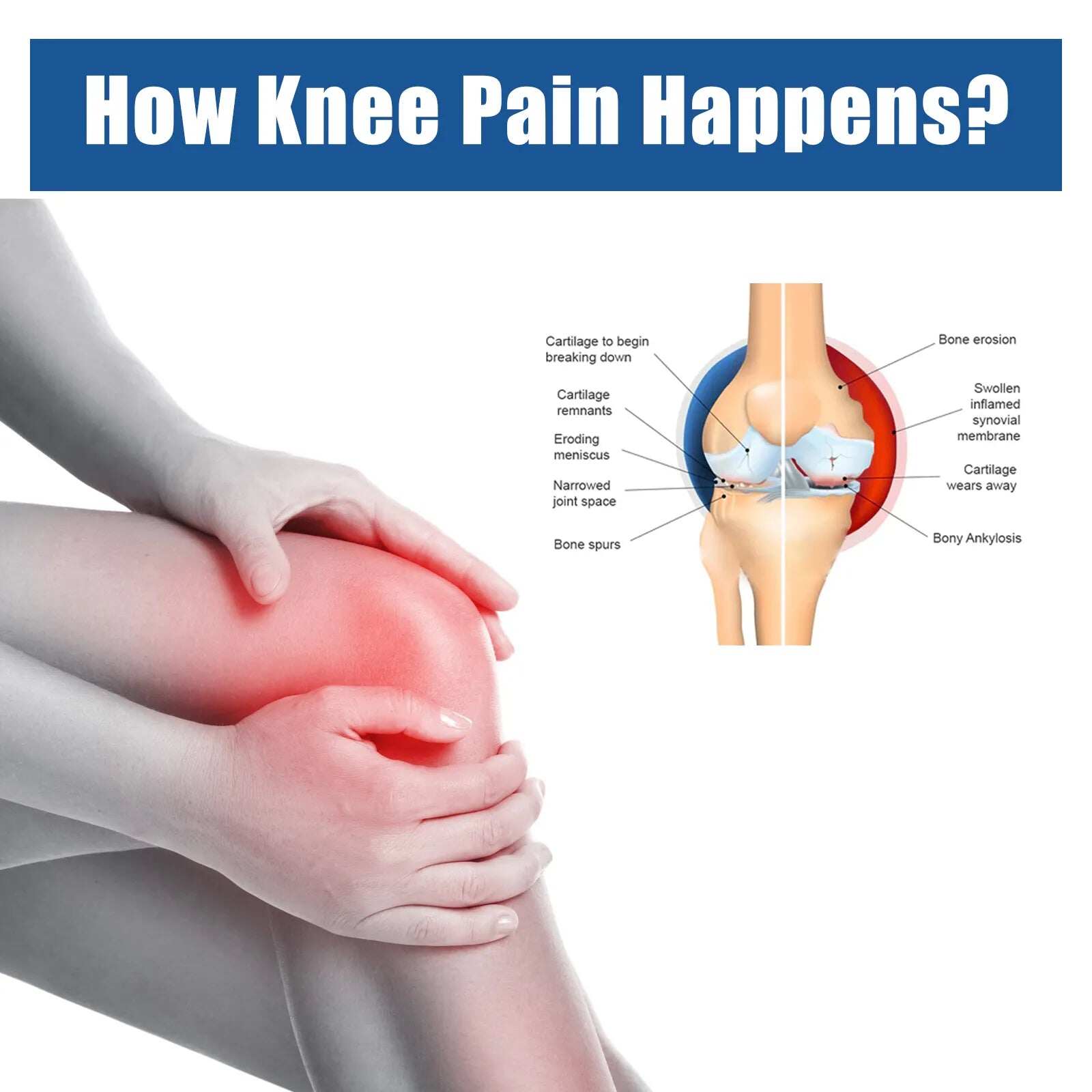 Adesivos para alívio da dor no joelho