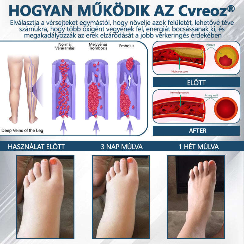 Cvreoz® Fekete kömény Ödéma méregtelenítő gyógynövénykrém💙