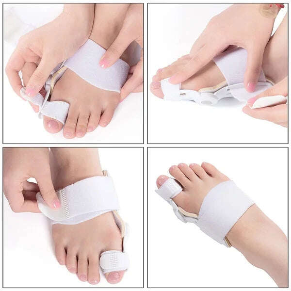 【Doctor recommended】Bunion Corrector para homens e mulheres