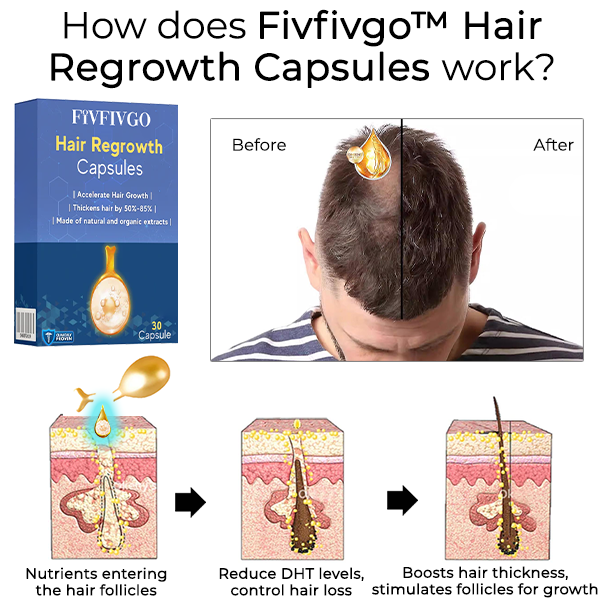 Cápsulas de crescimento capilar Fivfivgo™