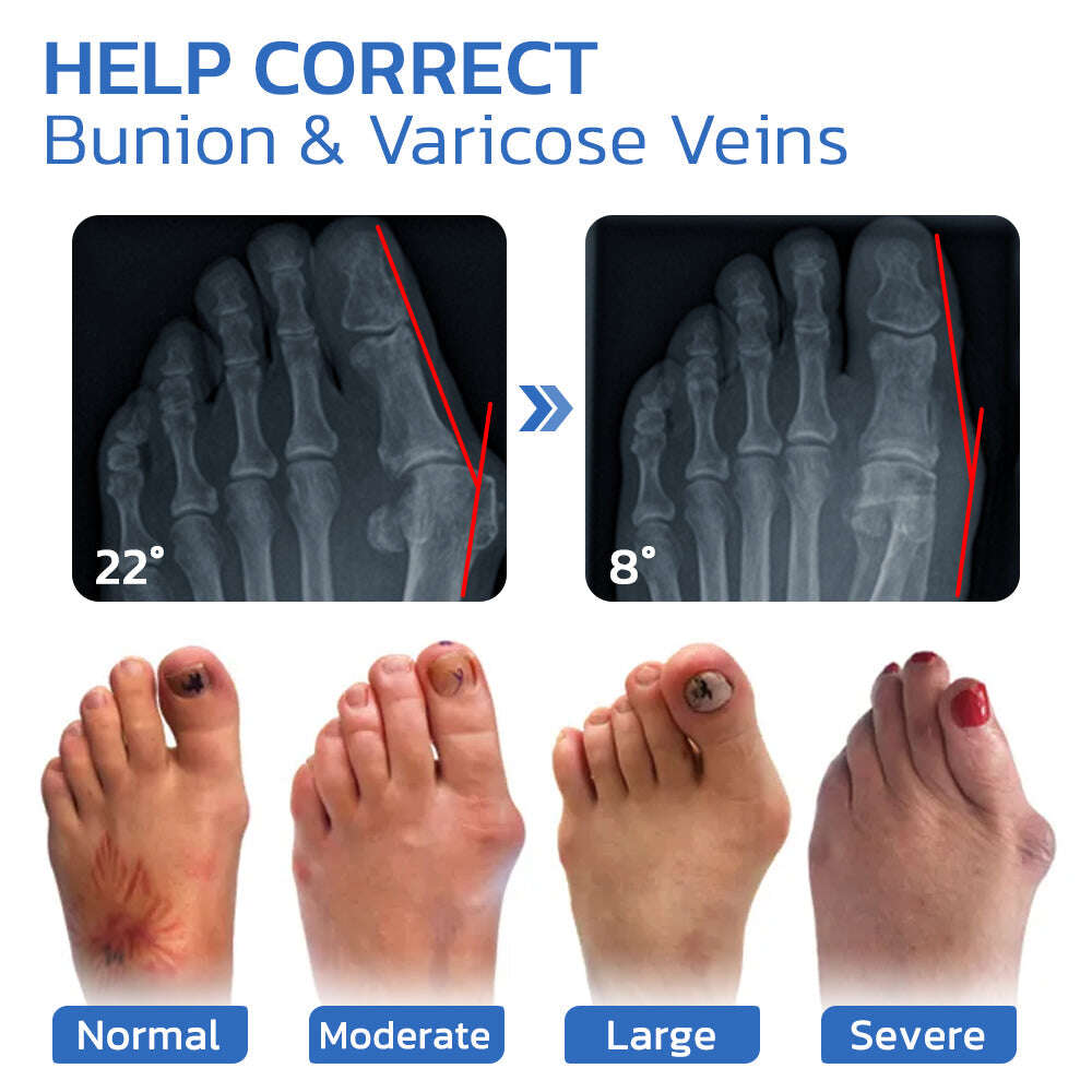 ЧОРАПИ ЗА ЗДРАВЕ GFOUK™ ANTIBUNION И VEINHEAL