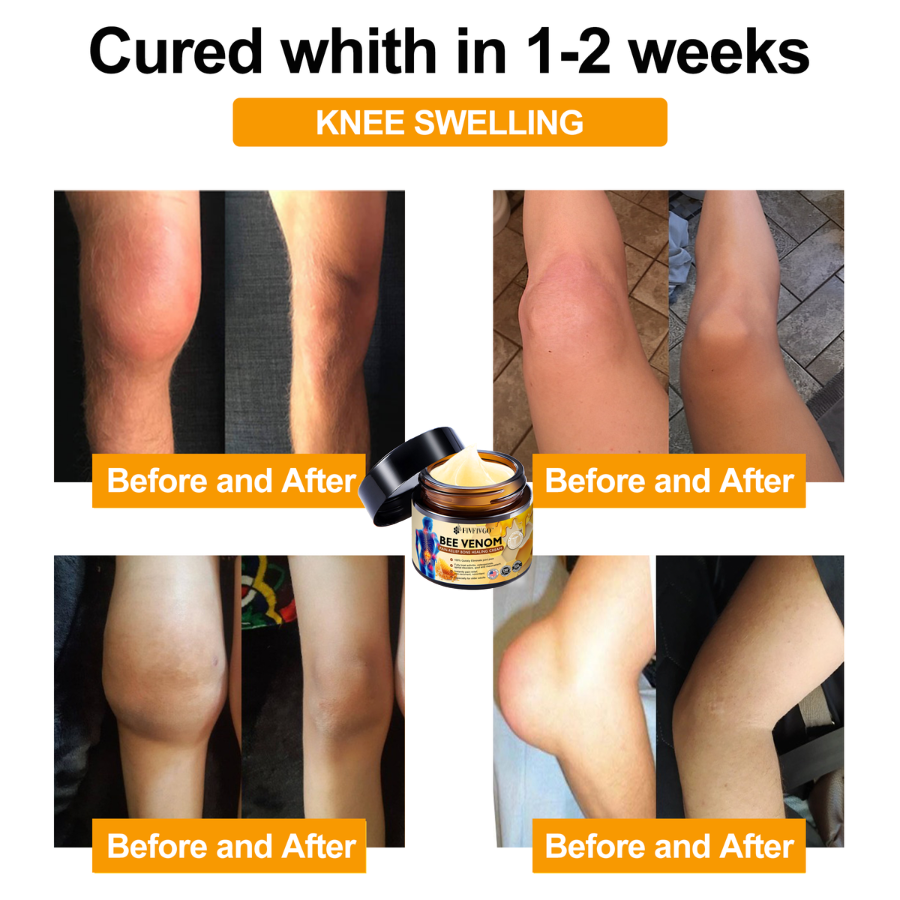 Fivfivgo™ Bee Venom Instant Ultra Strength Pain Relief Therapy Cream (Elimina a dor para artrite, dores musculares, nas costas, joelhos, costas, ombros, quadris, pulsos, mãos)