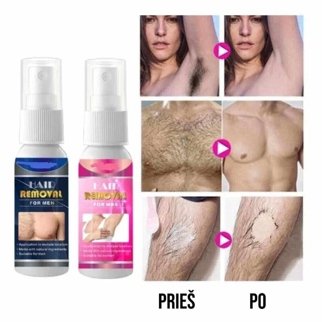 🔥Grande promoção 🔥Spray corporal depilatório