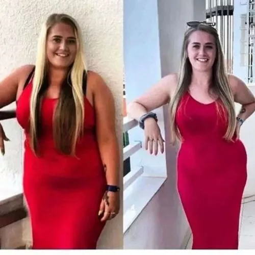 ТУРМАЛИНОВИ МЕДИЦИНСКИ ЧОРАПИ ЗА ОТСЛАБВАНЕ НА ЛИМФНИ ВЪЗЛИ AFIZ