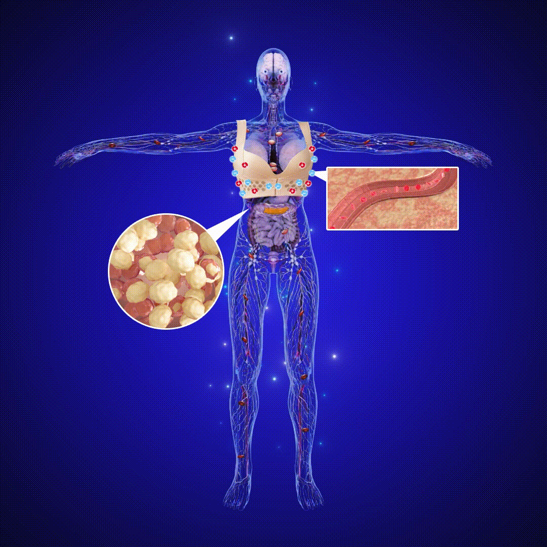 Oferta limitada (só restam 3)!! Obtenha 50% de desconto no sutiã de desintoxicação linfática Beslife™ para moldar e firmar os seios e levantar a postura