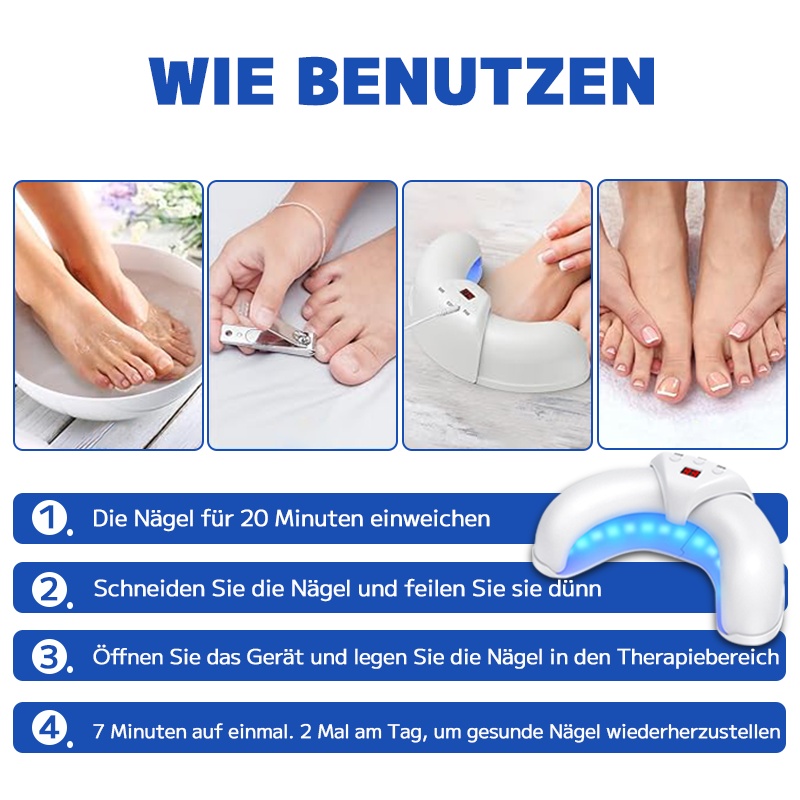 FURZERO™ ЛАЗЕРЕН АПАРАТ ЗА ЛЕЧЕНИЕ НА ГЪБИЧКИ ПО НОКТИ