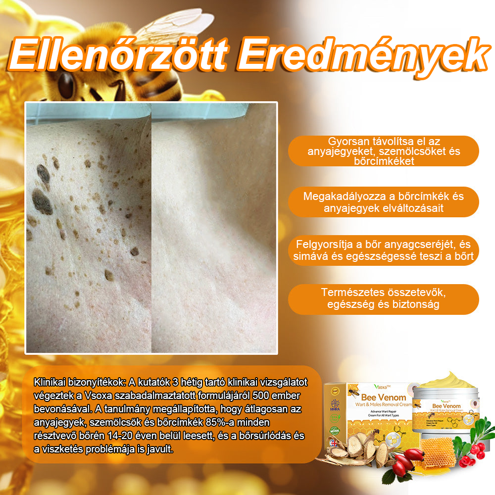 Creme para remoção de verrugas e verrugas com veneno de abelha Vsoxa™ (venda no último dia, 80% de desconto)