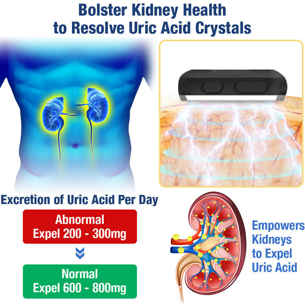 Устройство за микротокова терапия GFOUK™ UricEase