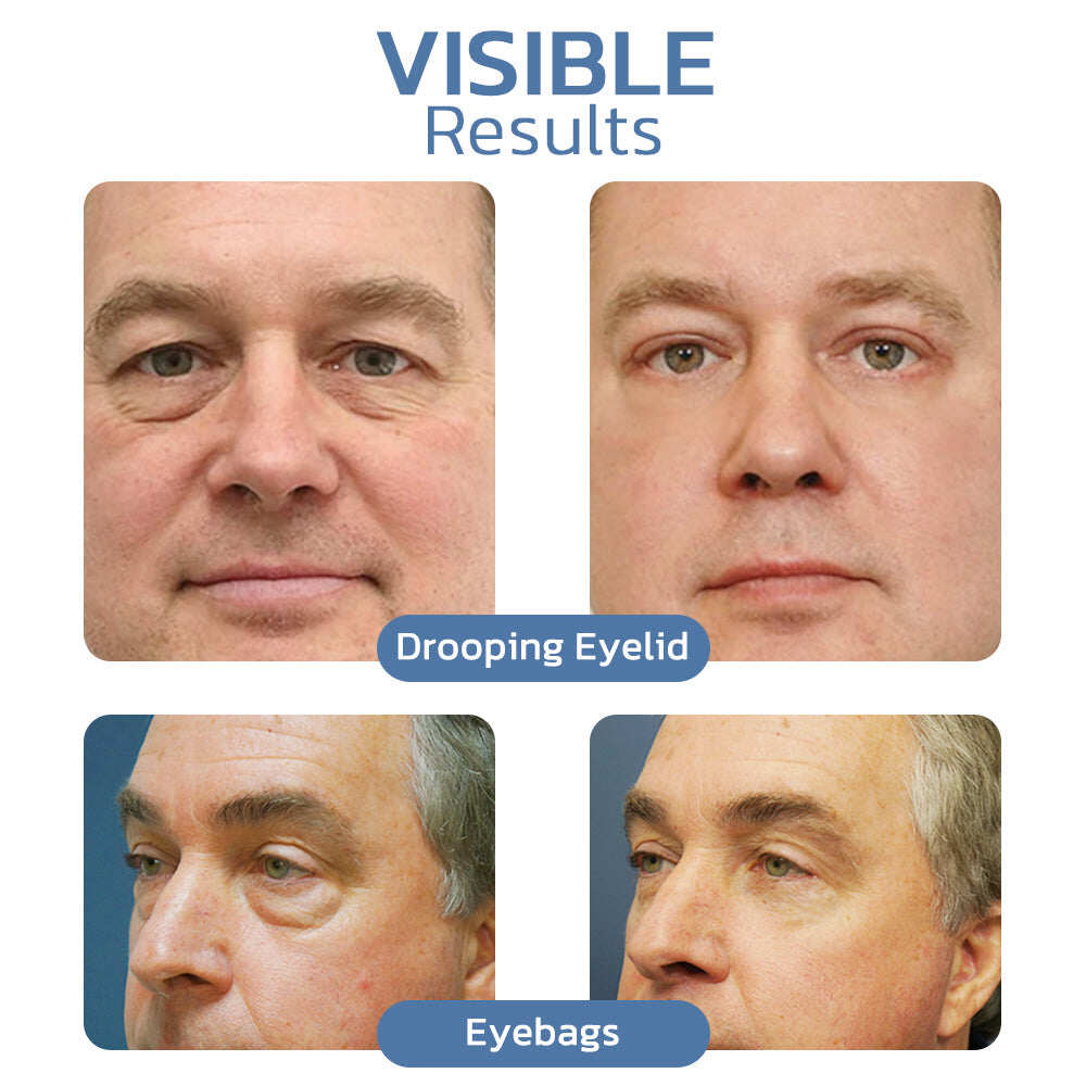 OPENEYES Awaken Peptide Liftingujący żel pod oczy